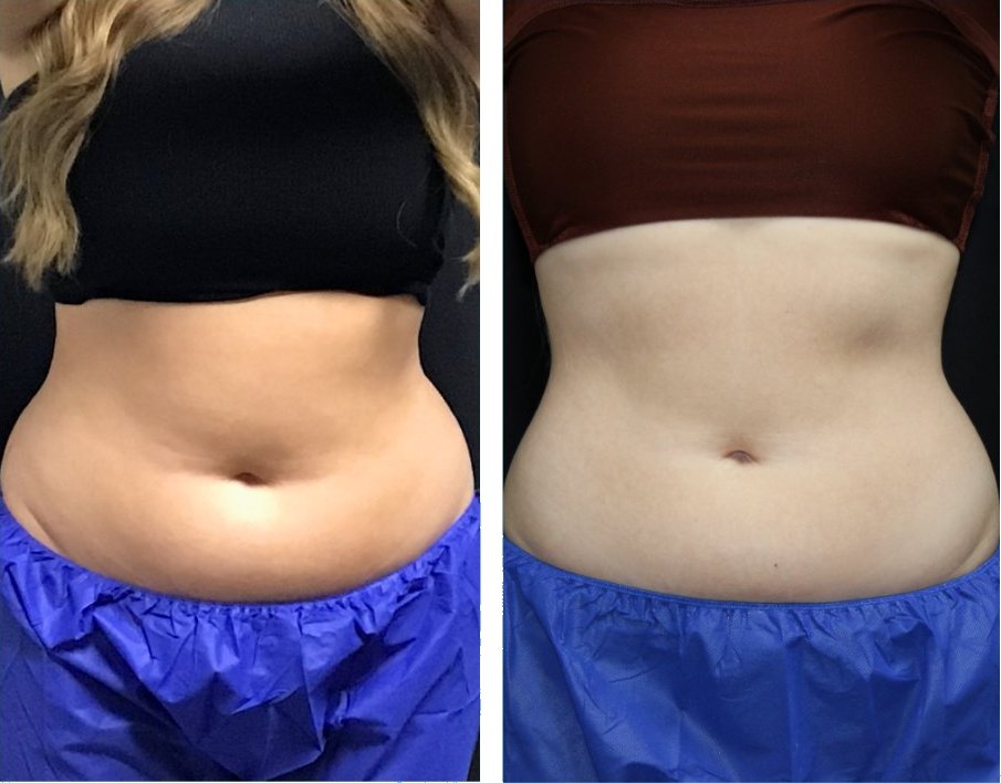 how to make the most of semaglutide 🥇 What to Eat and What to Avoid When Taking Semaglutide for Weight Loss: A  Guide